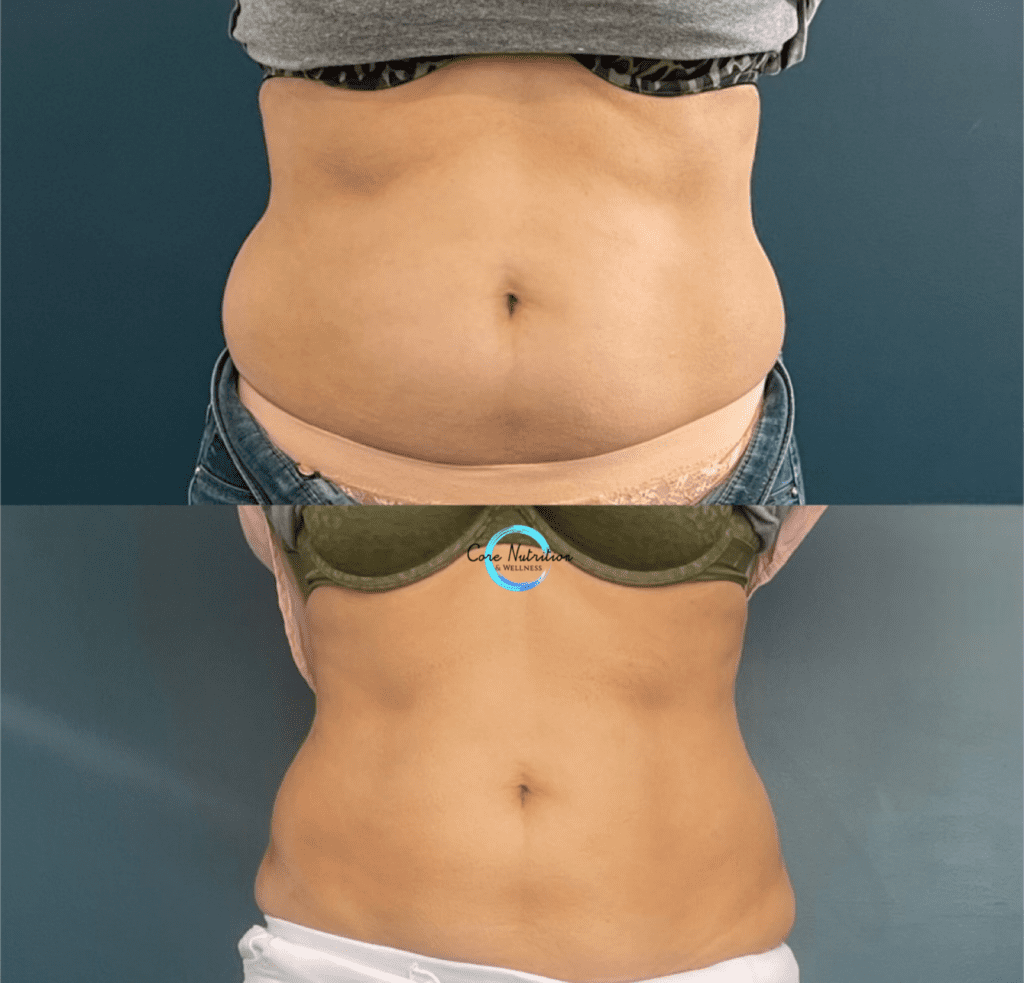 Who can Neveskin Shape & Tone help?